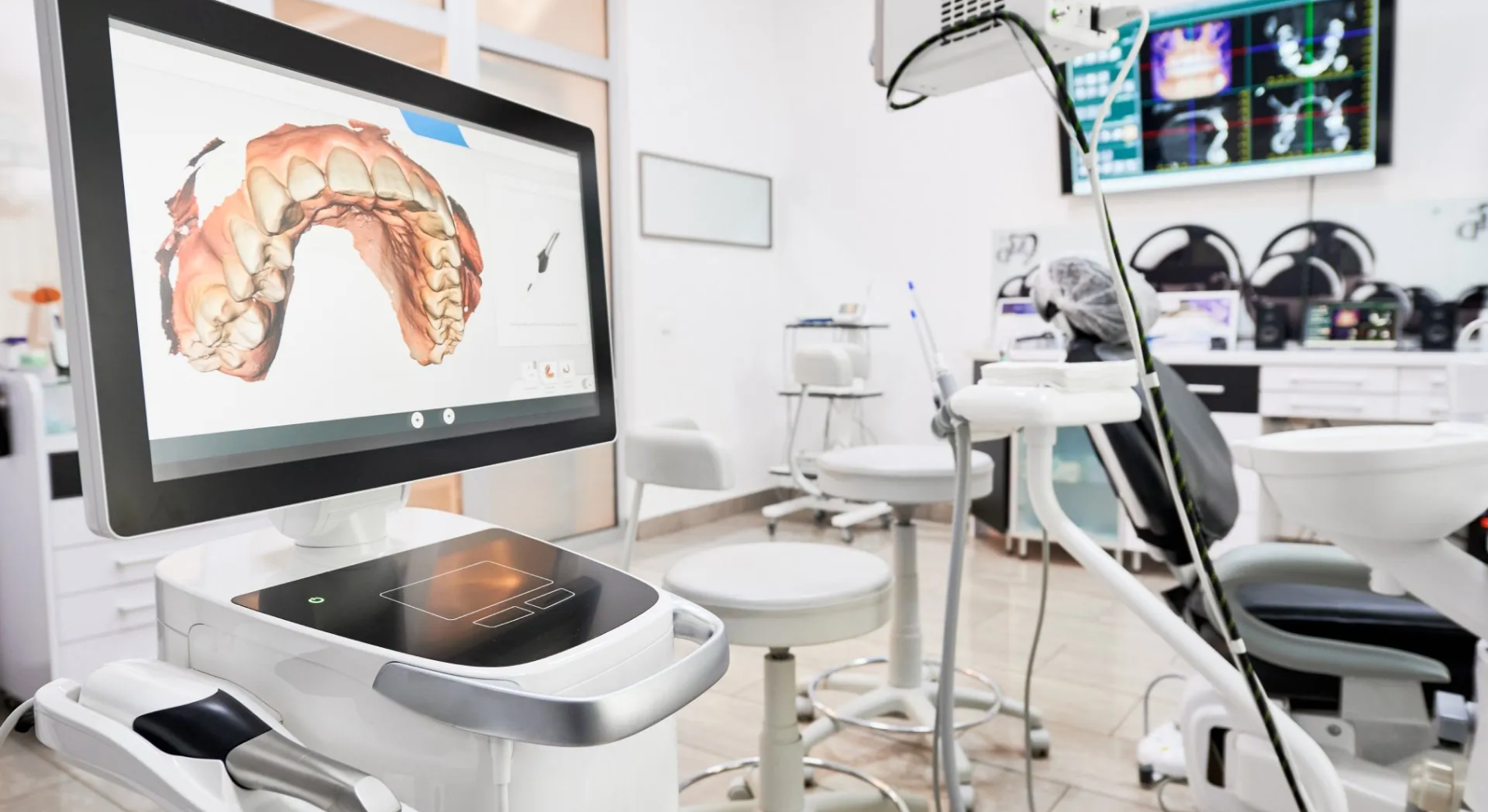 camera-intra-orale-dentiste alfortville paris