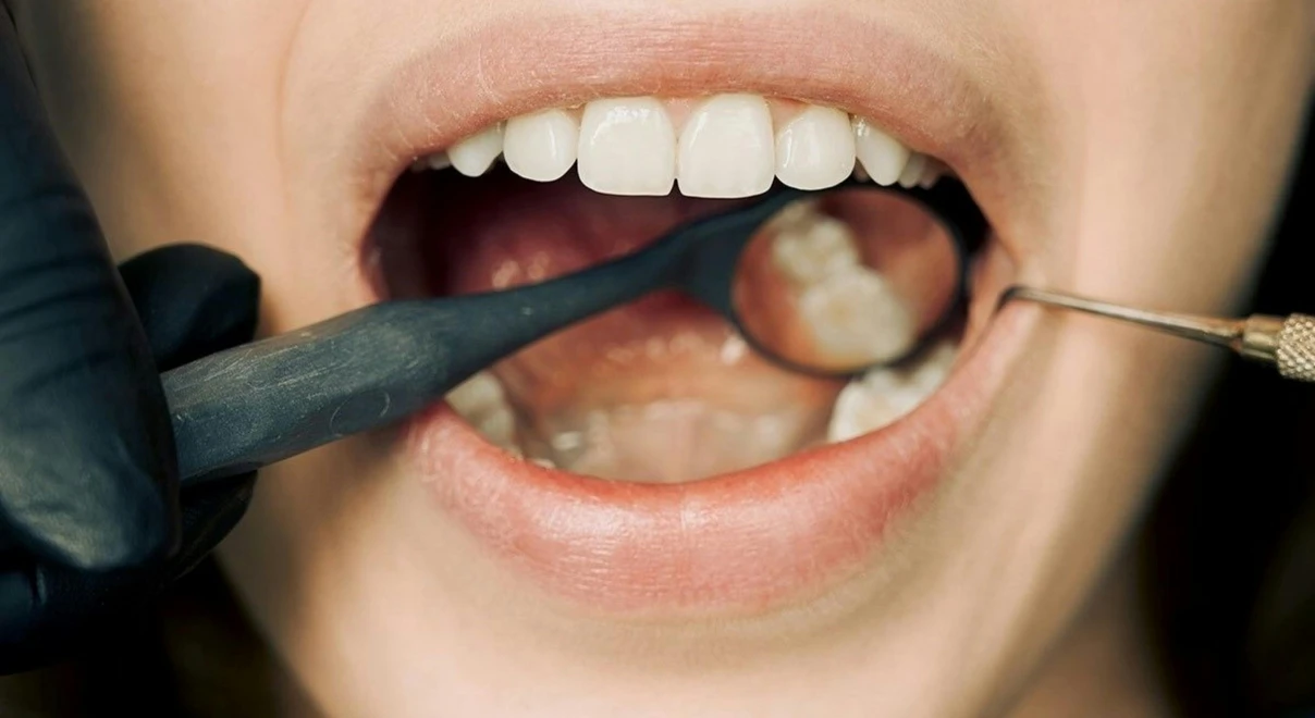 dentiste-alfortville-soin dentaire