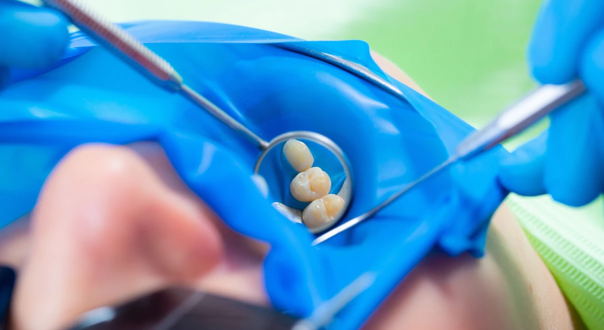 digue-champ-operatoire-dentiste alfortville