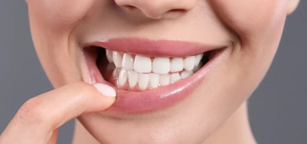 Parodontie médicale Dentiste Alfortville, près de Paris